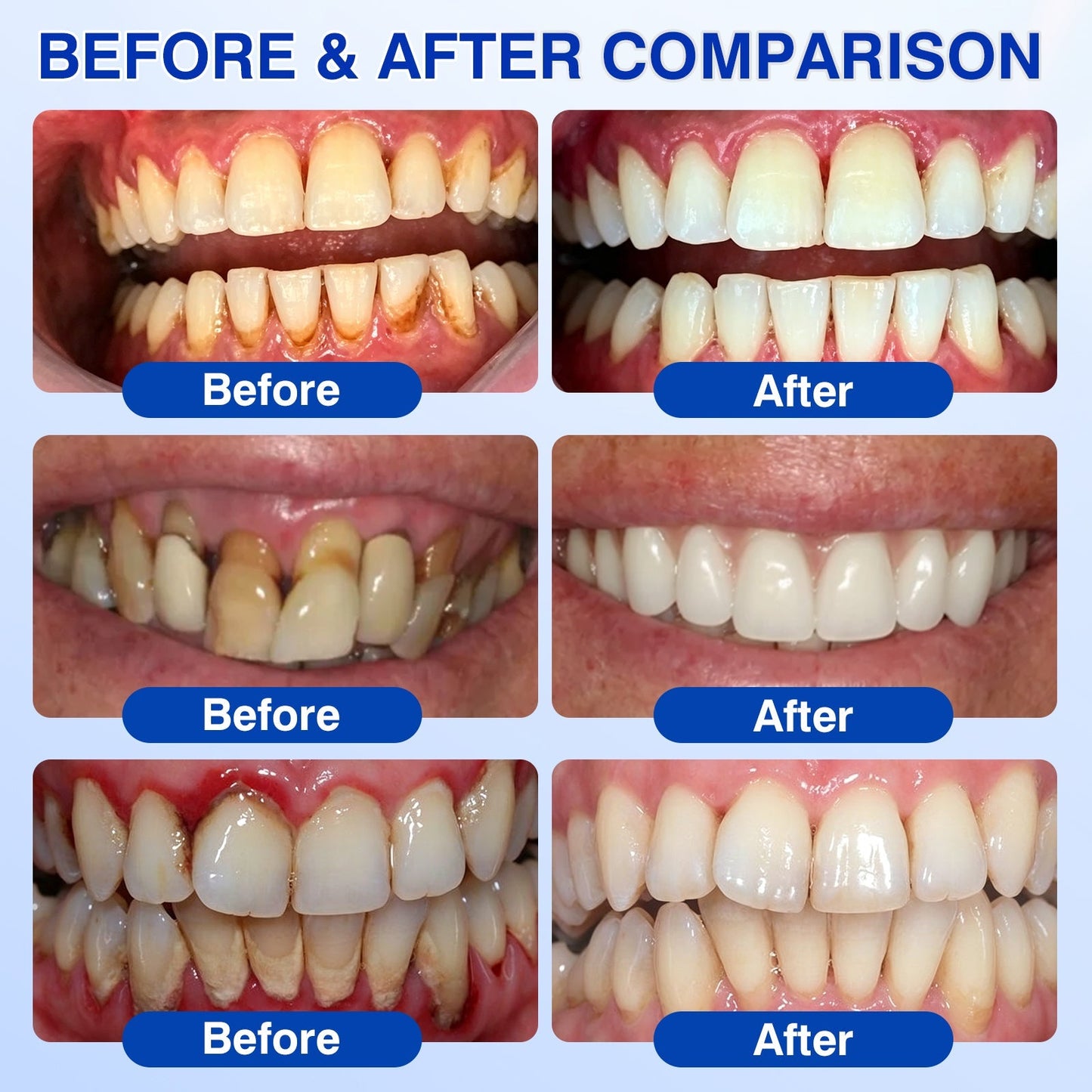🇺🇸🏅🦷💫𝐍𝐚𝐭𝐫𝐚𝐯𝐨𝐫® GumRevive Periodontal Repair Gel