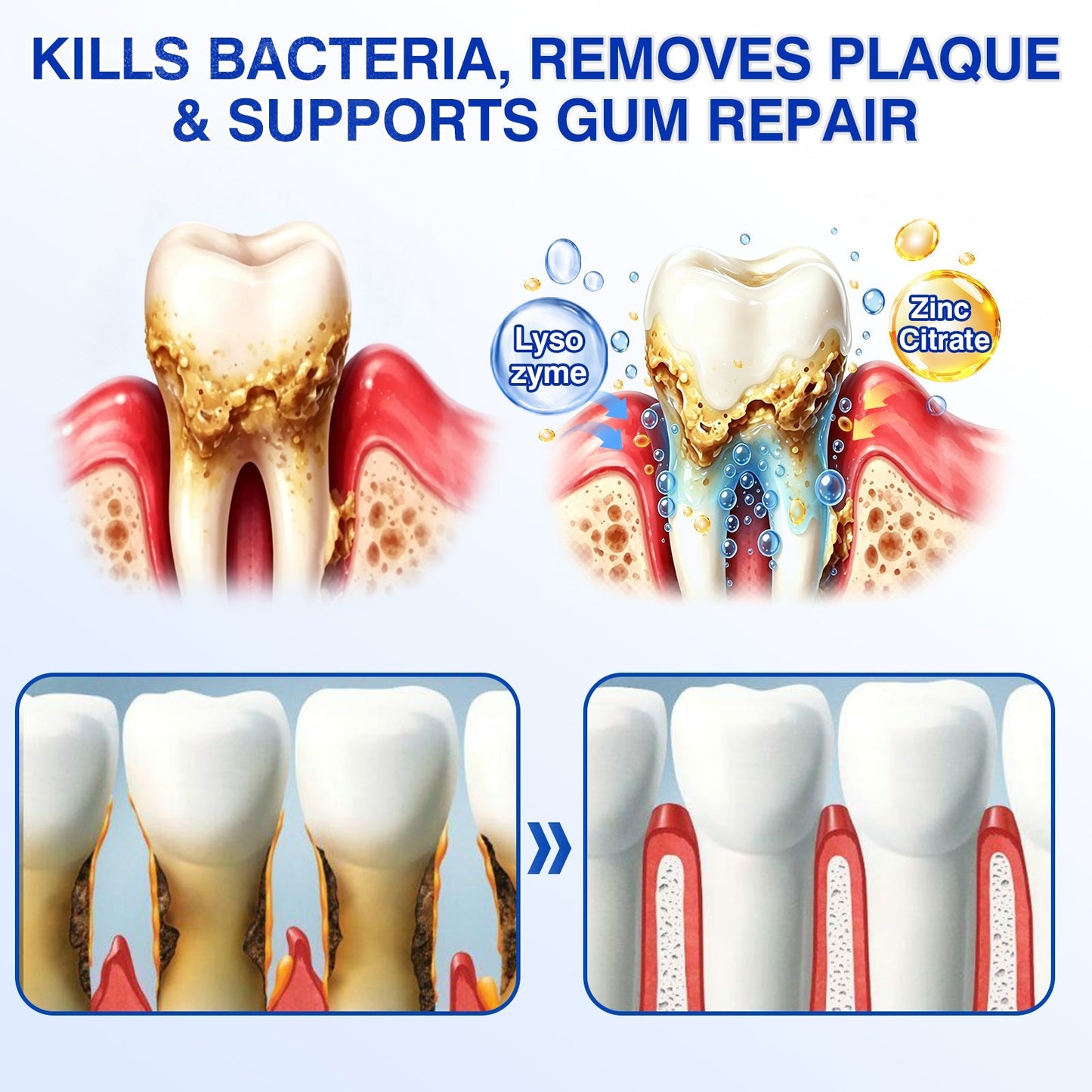🇺🇸🏅🦷💫𝐍𝐚𝐭𝐫𝐚𝐯𝐨𝐫® GumRevive Periodontal Repair Gel