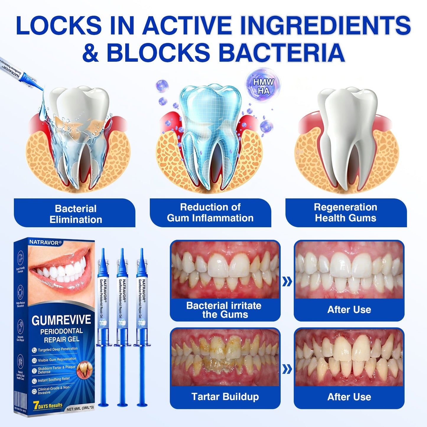 🇺🇸🏅🦷💫𝐍𝐚𝐭𝐫𝐚𝐯𝐨𝐫® GumRevive Periodontal Repair Gel